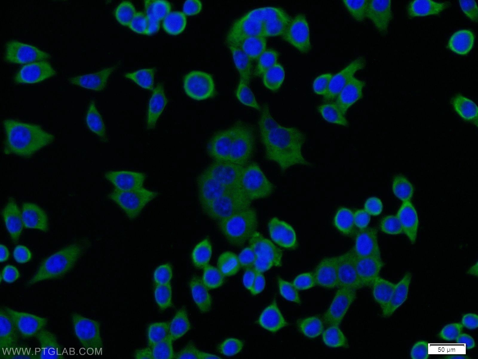 IF Staining of BxPC-3 using 11334-1-AP