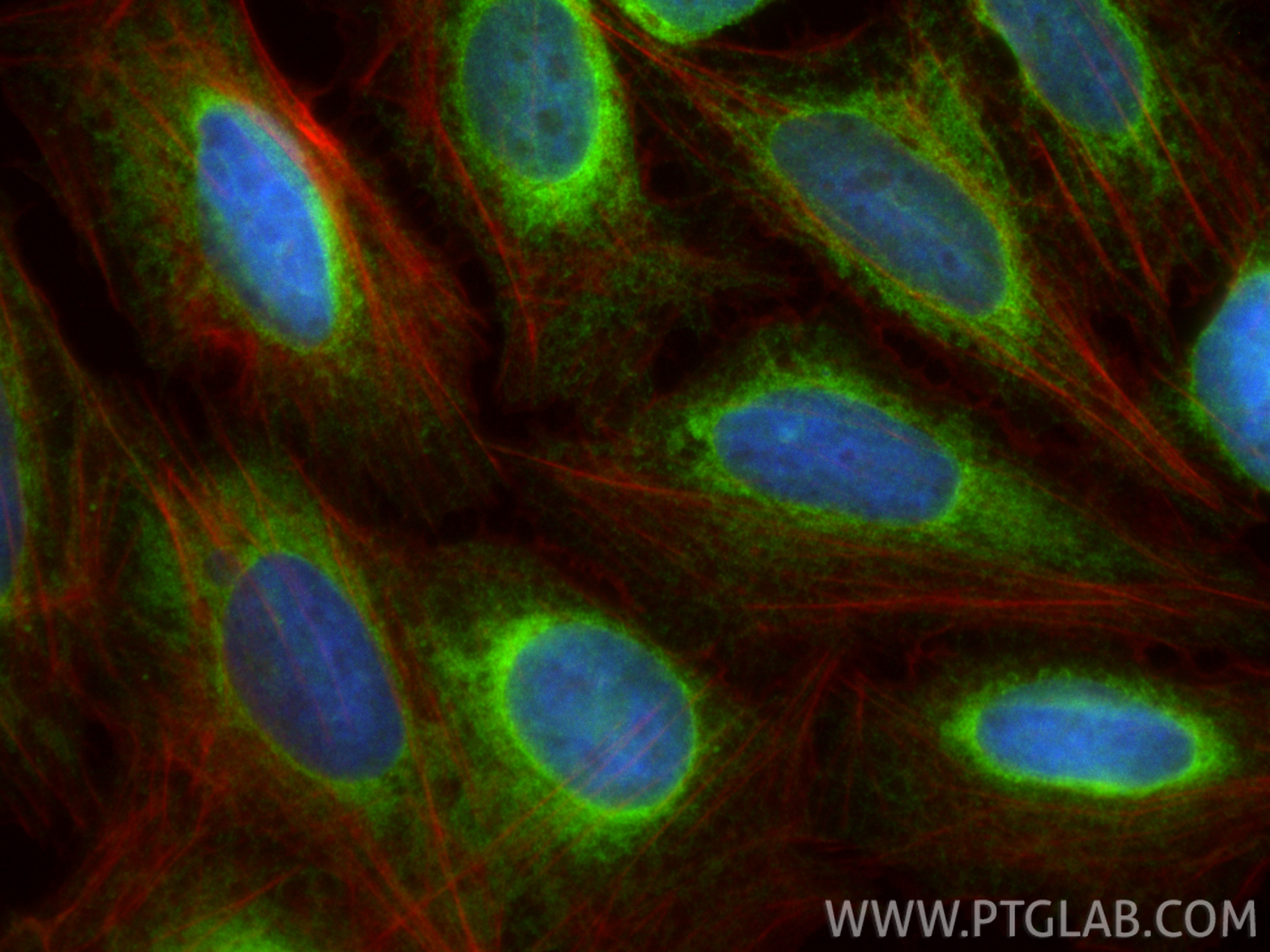 IF Staining of U2OS using 11334-1-AP