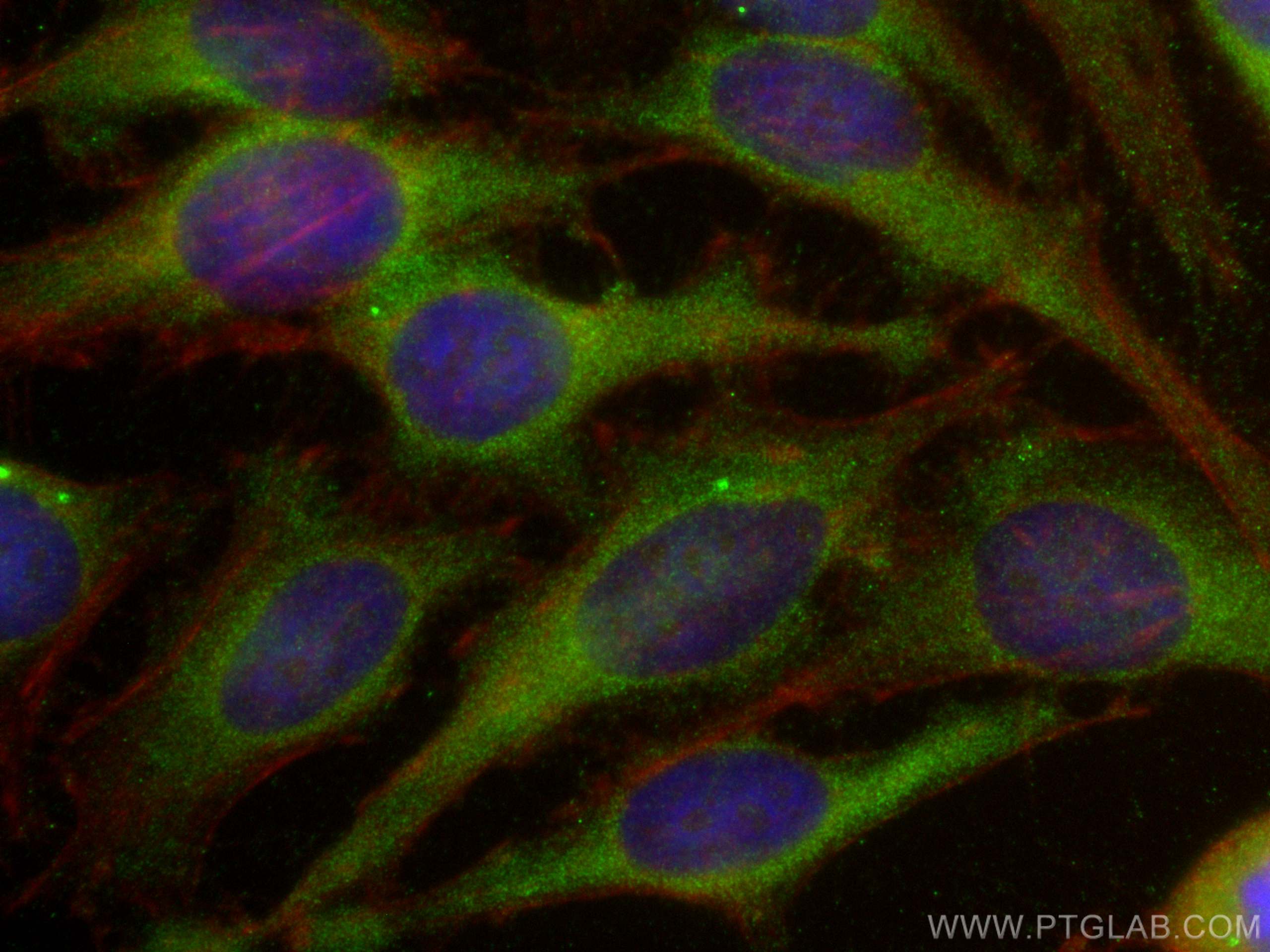 IF Staining of HeLa using 20145-1-AP