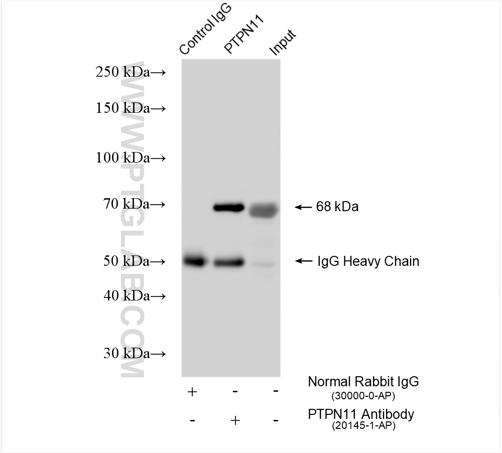 IP experiment of HEK-293 using 20145-1-AP
