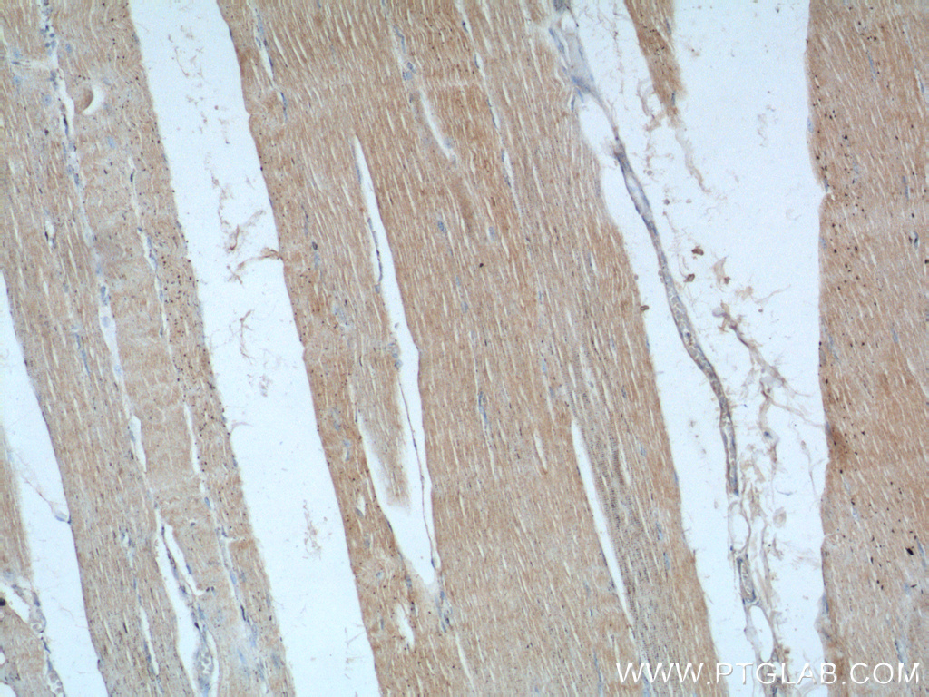 IHC staining of human skeletal muscle using 24570-1-AP