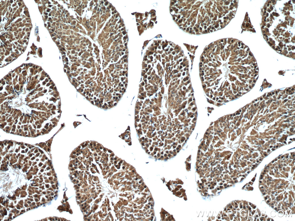 IHC staining of mouse testis using 66795-1-Ig