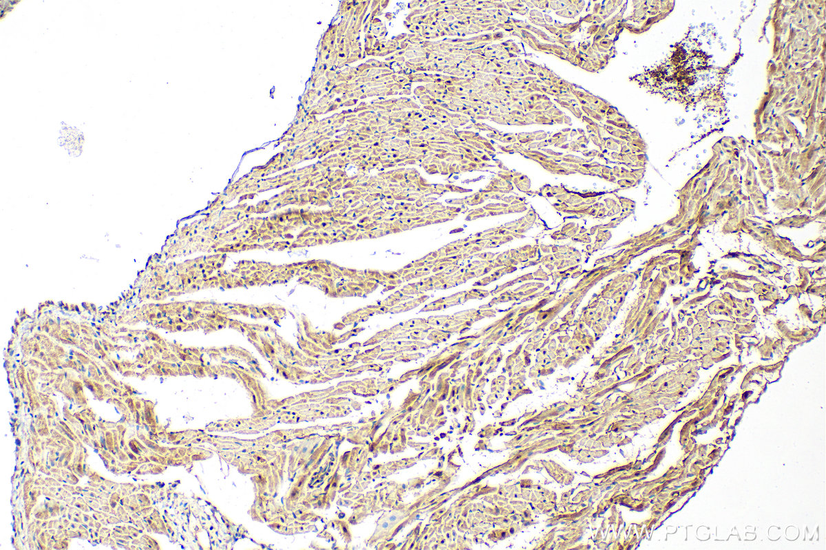 IHC staining of rat heart using 82503-1-RR