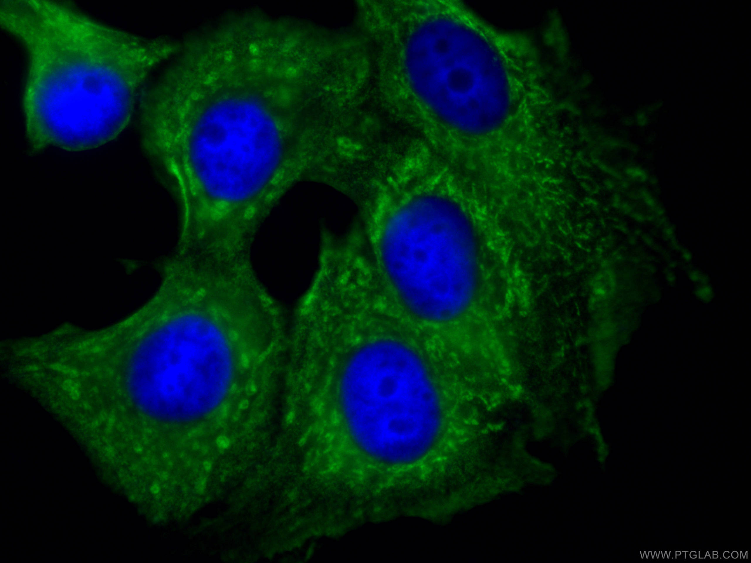 IF Staining of MCF-7 using CL488-66795