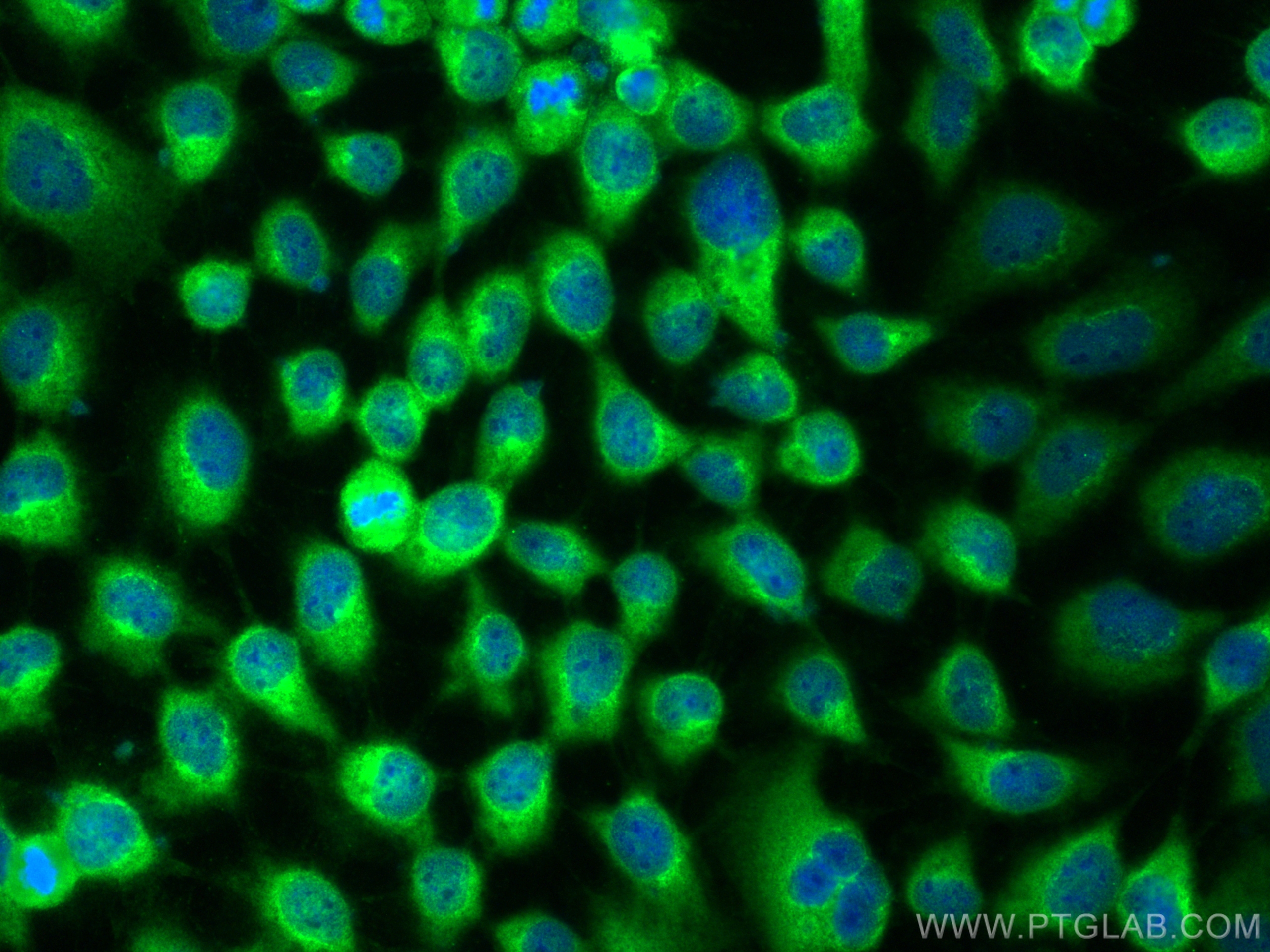 IF Staining of A431 using 31215-1-AP (same clone as 31215-1-PBS)