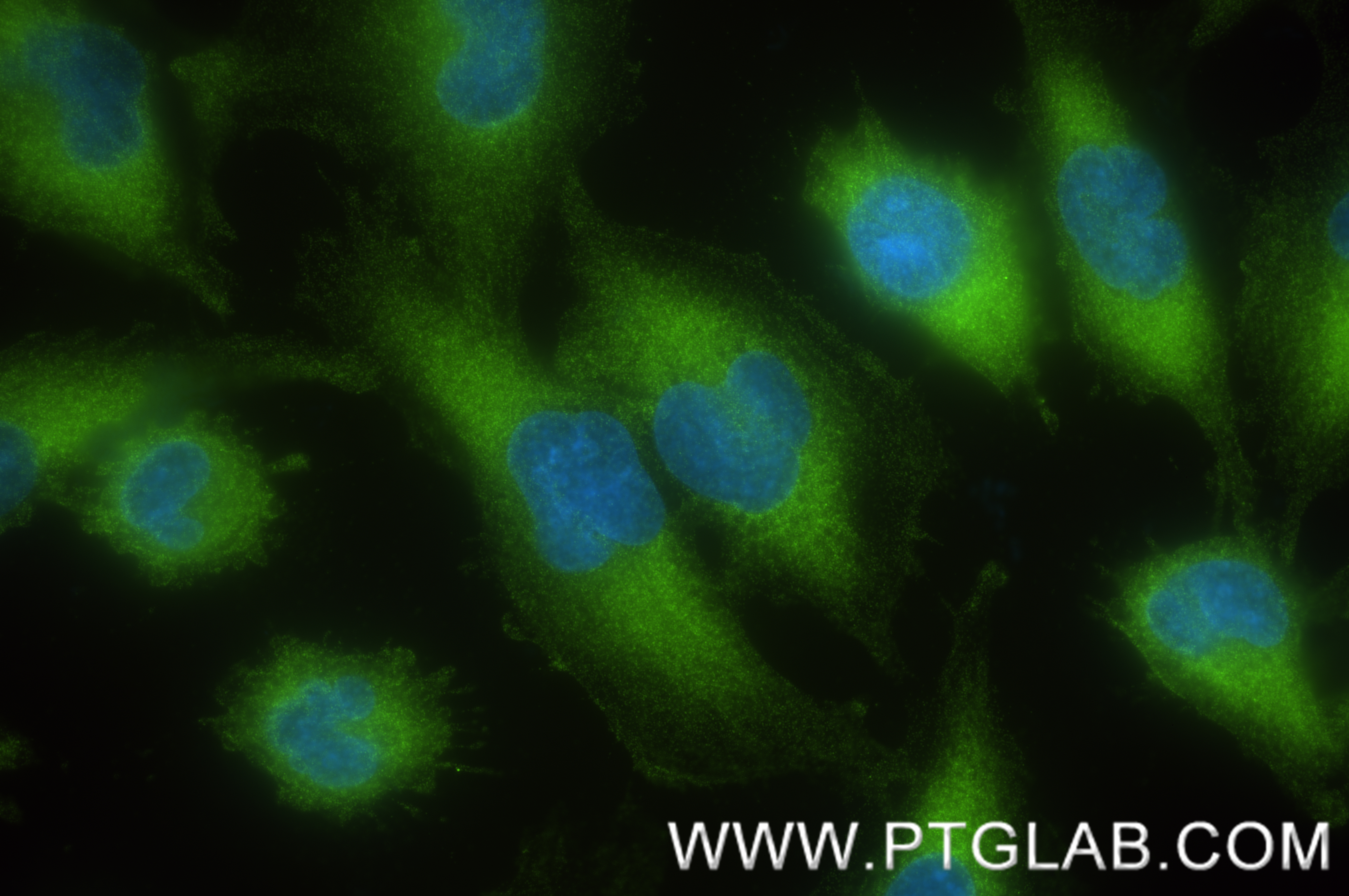 IF Staining of U-251 using 83851-6-RR (same clone as 83851-6-PBS)