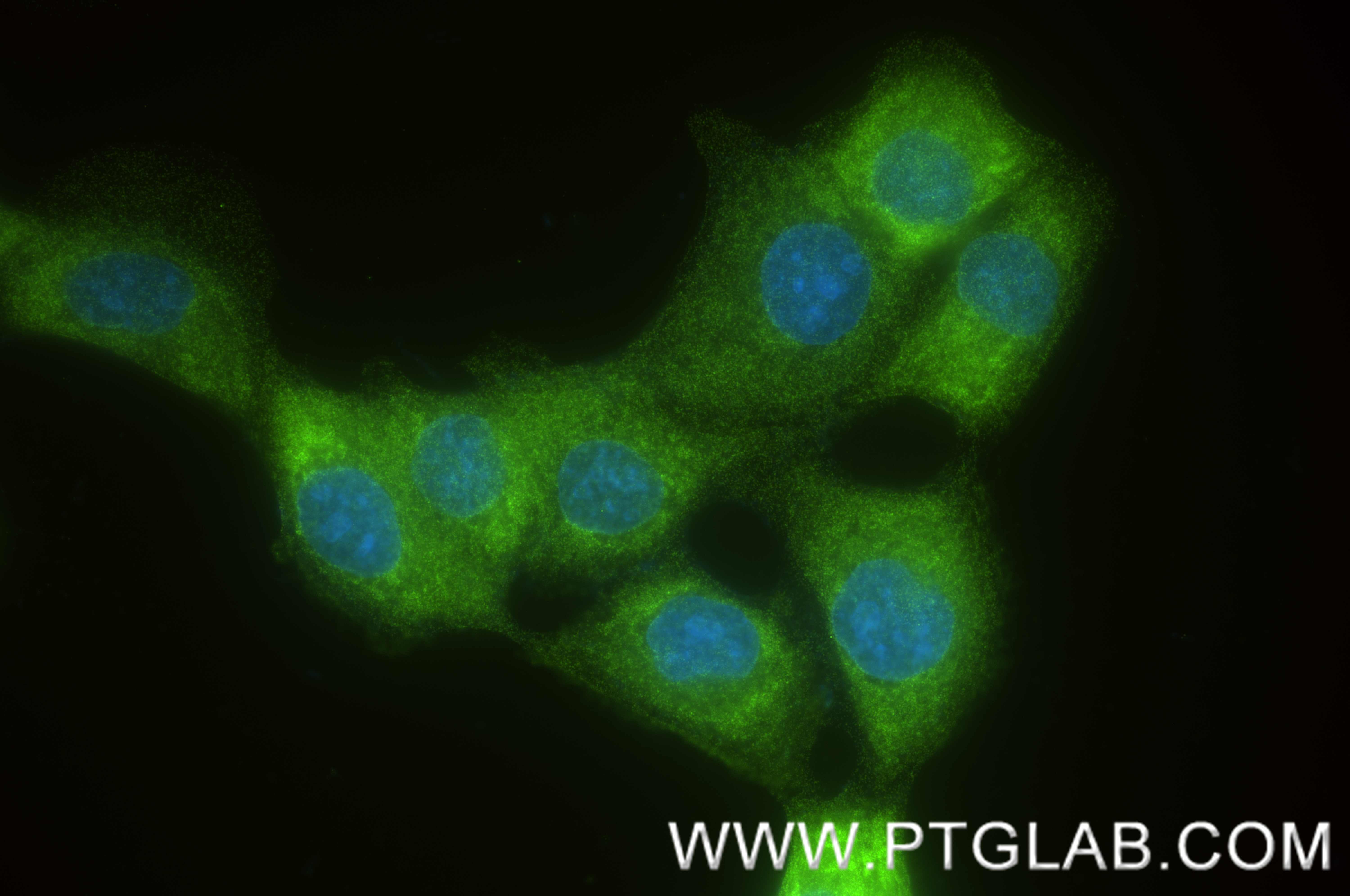 IF Staining of A431 using 83851-6-RR (same clone as 83851-6-PBS)