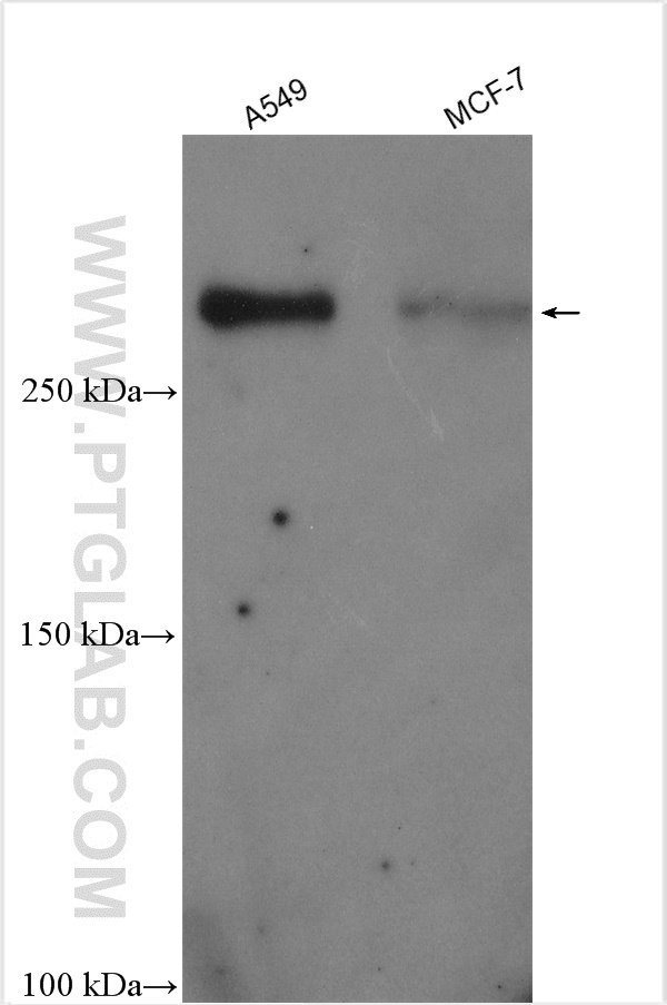 WB analysis using 25944-1-AP