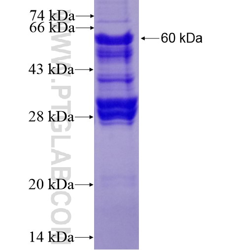 PTPN18 fusion protein Ag11704 SDS-PAGE