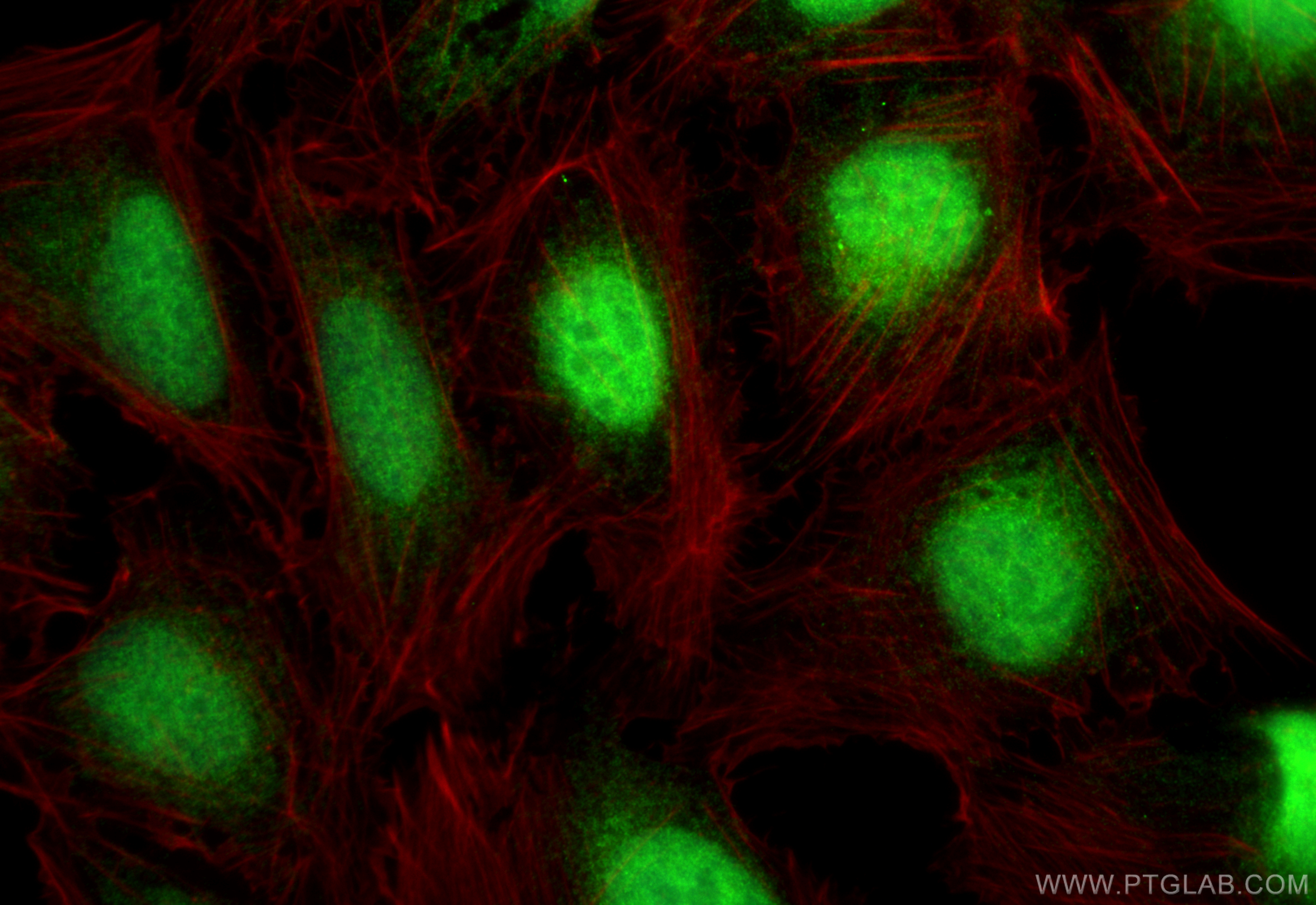IF Staining of U2OS using 11214-1-AP