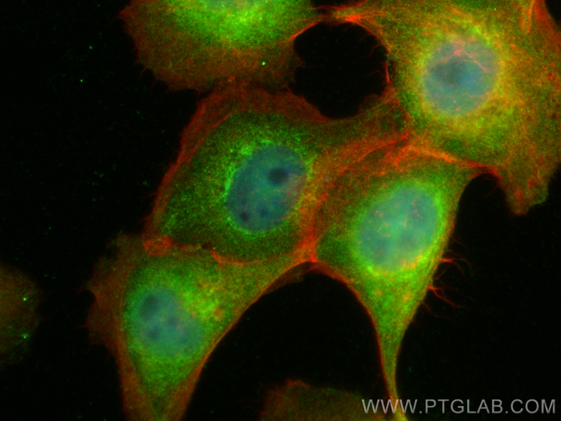IF Staining of A431 using 19510-1-AP