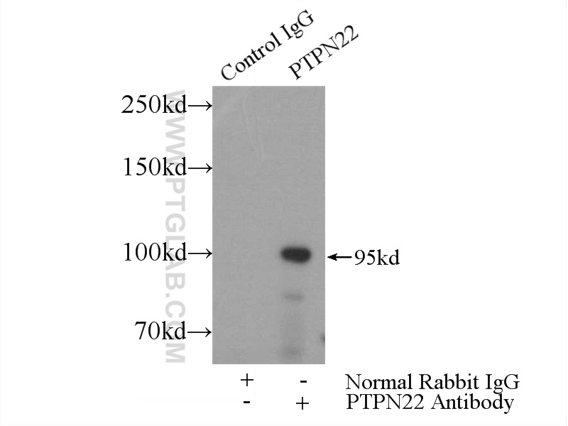 IP experiment of Jurkat using 11783-1-AP