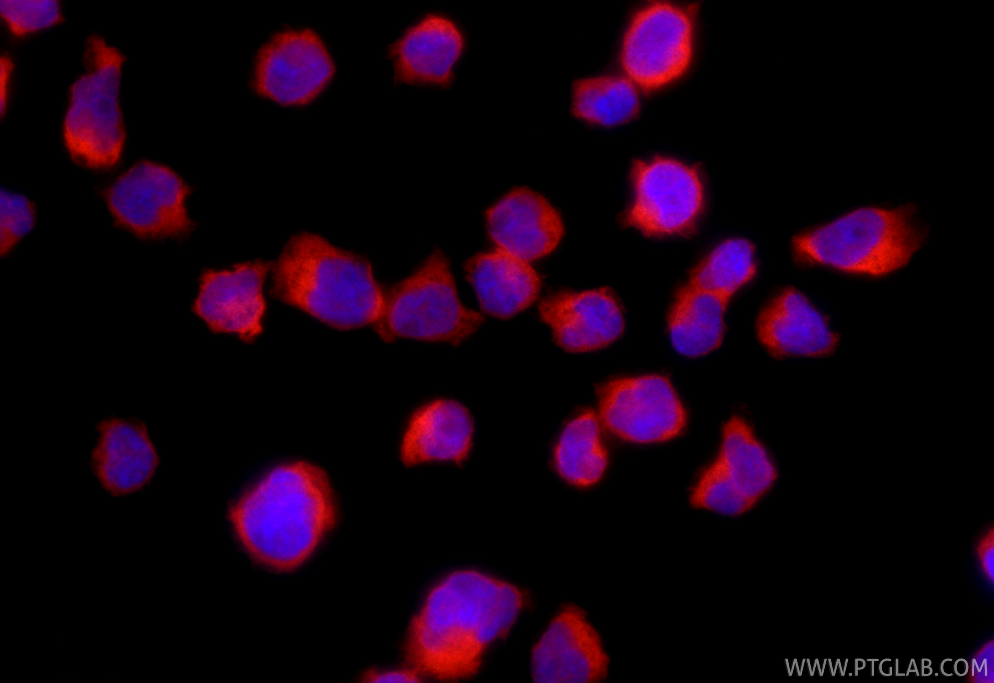 IF Staining of Jurkat using CL594-85062-4