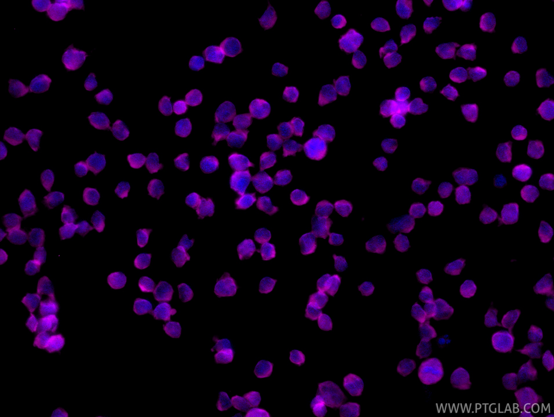 IF Staining of Jurkat using CL647-85062-4 IF Staining of Jurkat using CL647-85062-4