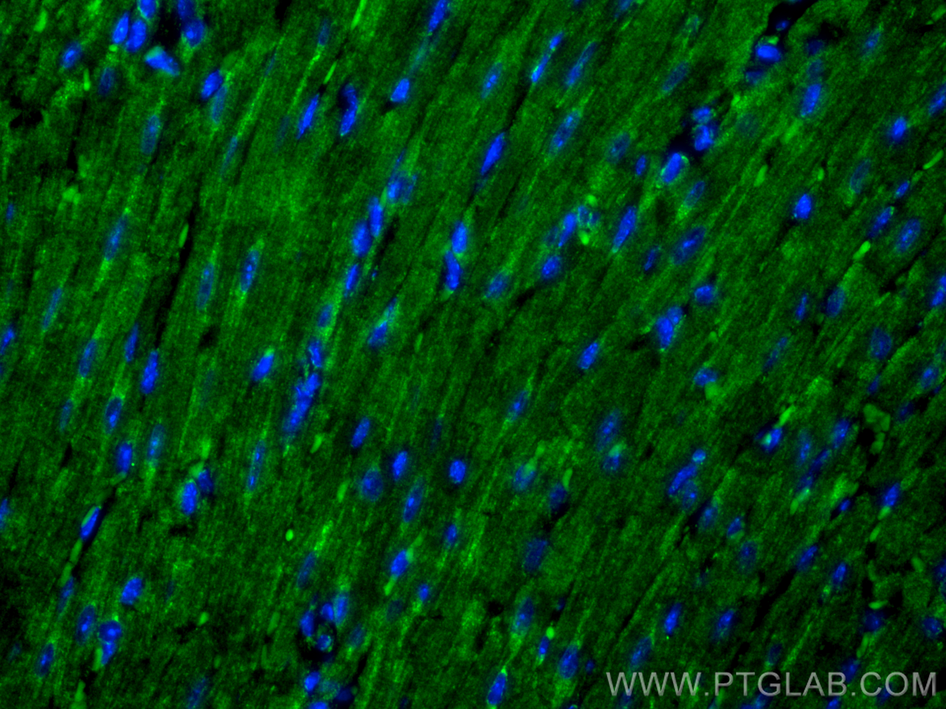 Immunofluorescent analysis of (4% PFA) fixed paraffin-embedded mouse heart tissue using PTPN23 antibody (10472-1-AP) at dilution of 1:200 and CoraLite®488-Conjugated Goat Anti-Rabbit IgG(H+L) (<a class='green' href='/productredirect?CatalogNo=SA00013-2' target='_blank'>SA00013-2</a>). Heat mediated antigen retrieval with Tris-EDTA buffer (pH 9.0). IF Staining of mouse heart using 10472-1-AP
