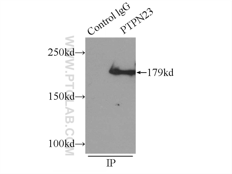 IP experiment of HeLa using 10472-1-AP