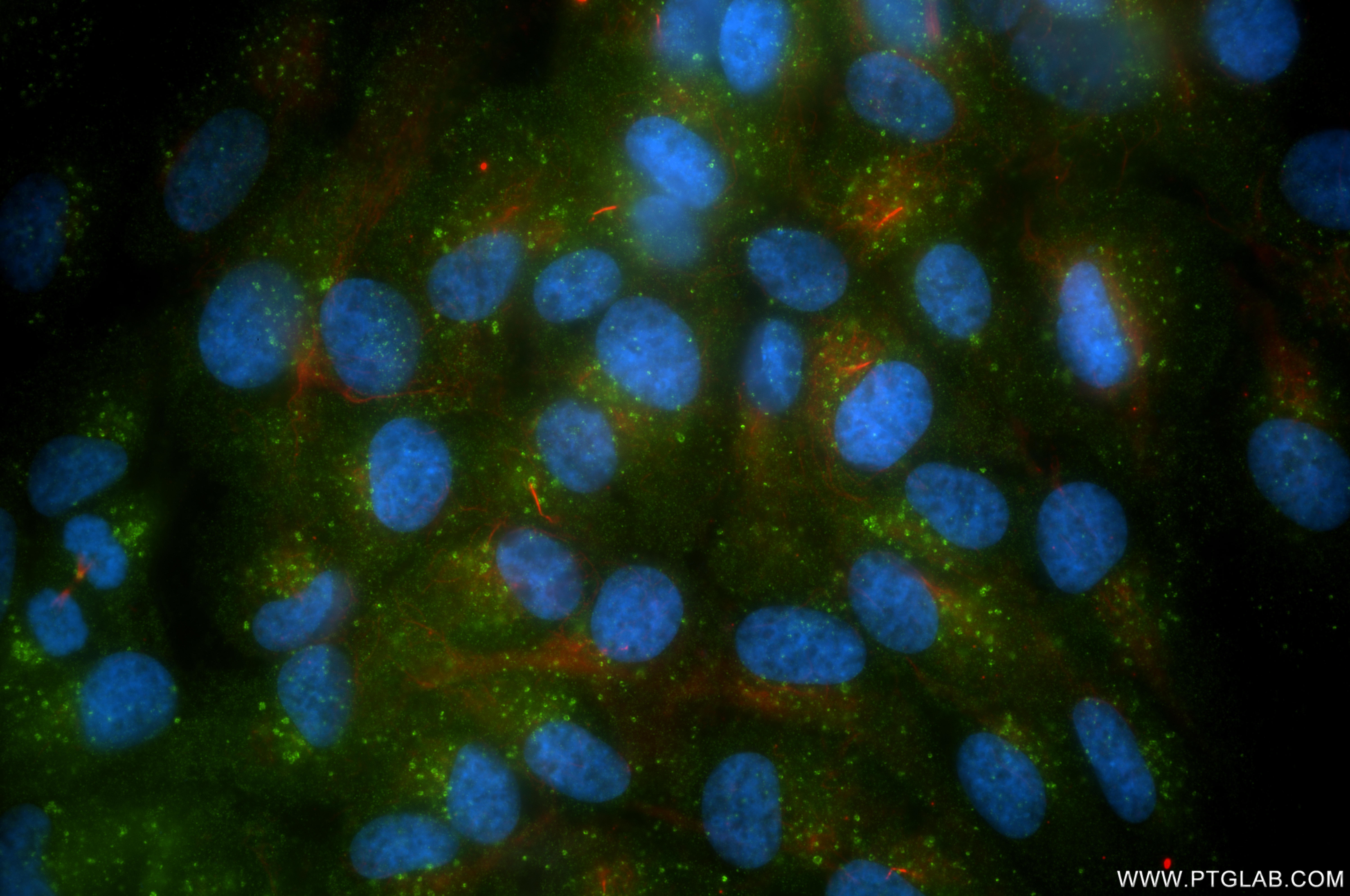 IF Staining of hTERT-RPE1 using 87561-1-RR