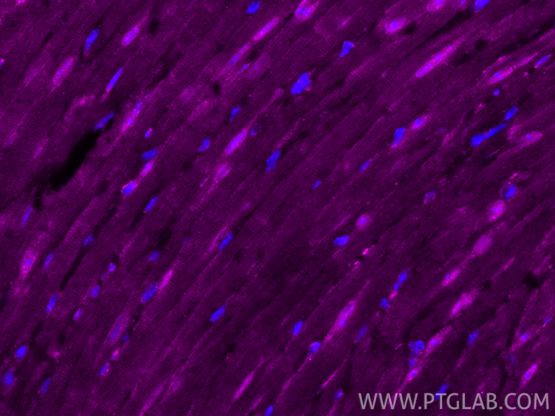Immunofluorescent analysis of (4% PFA) fixed paraffin-embedded mouse heart tissue using CoraLite®647 PTPN23 antibody (CL647-10472) at dilution of 1:200. Heat mediated antigen retrieval with Tris-EDTA buffer (pH 9.0). IF Staining of mouse heart using CL647-10472