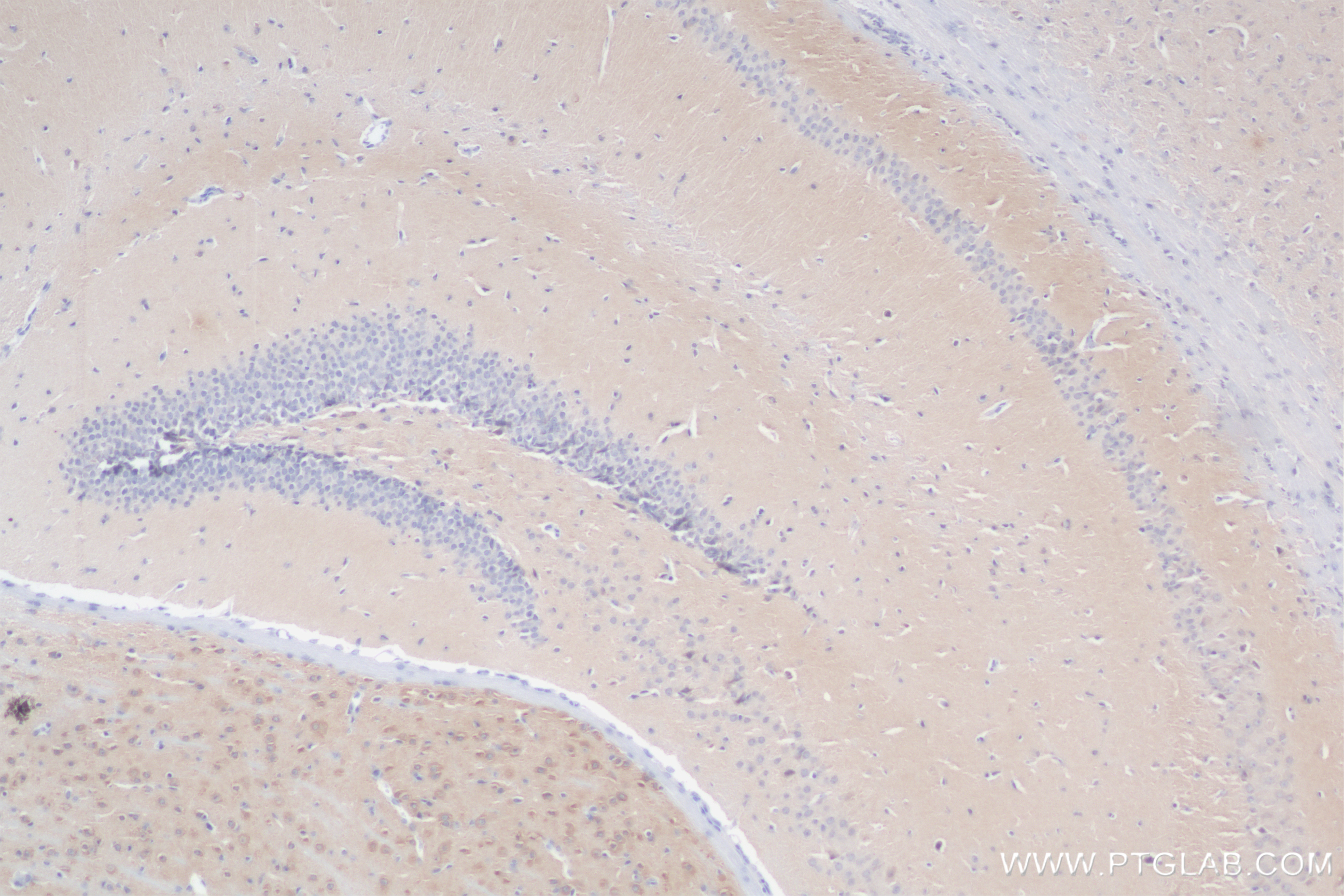 Immunohistochemical analysis of paraffin-embedded mouse brain tissue slide using <a class='green' href='/productredirect?CatalogNo=83695-1-RR' target='_blank'>83695-1-RR</a> (PTPN4 antibody) at dilution of 1:500 (under 10x lens). Heat mediated antigen retrieval with Tris-EDTA buffer (pH 9.0). This data was developed using the same antibody clone with 83695-1-PBS in a different storage buffer formulation. IHC staining of mouse brain using 83695-1-RR (same clone as 83695-1-PBS)