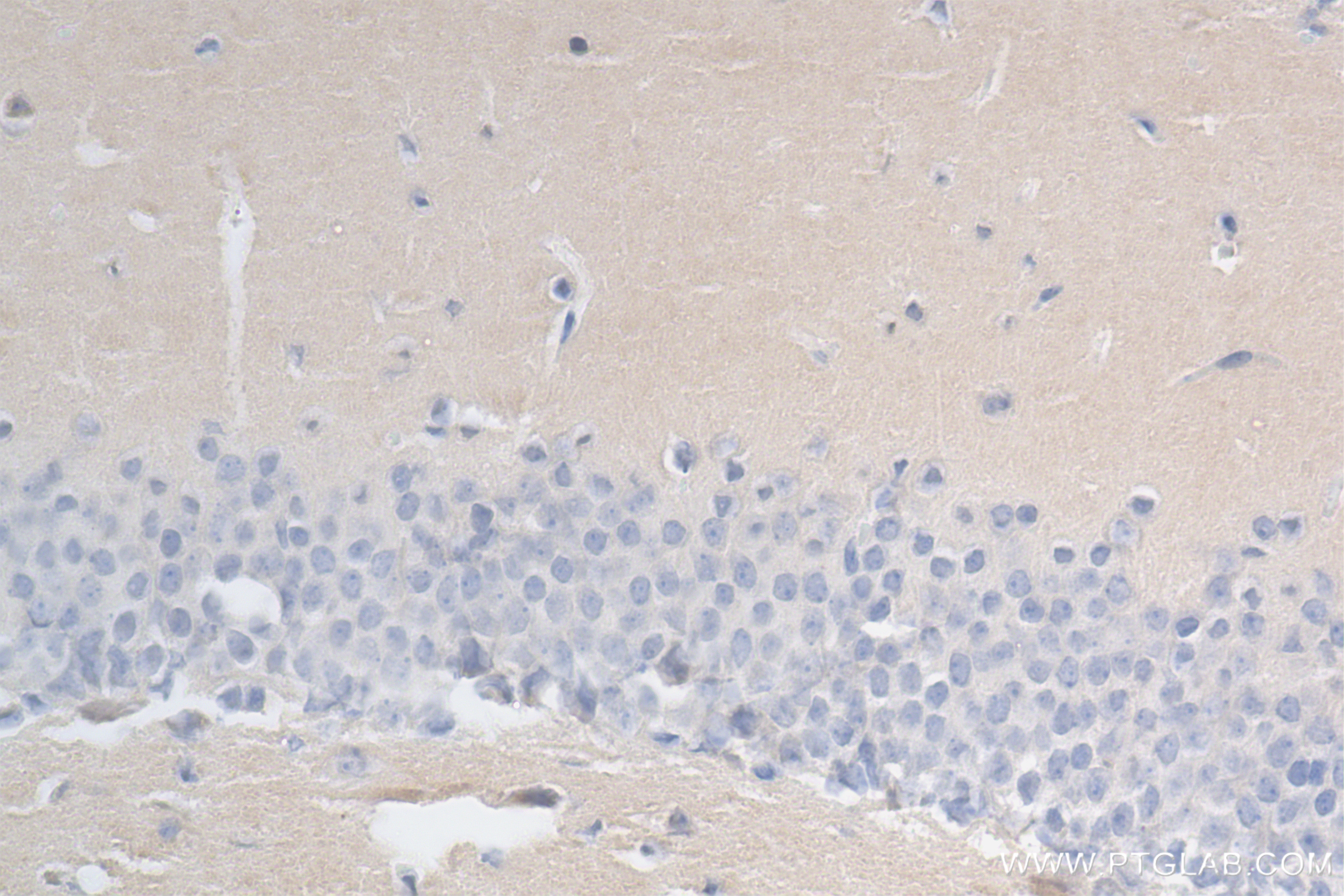 Immunohistochemical analysis of paraffin-embedded mouse brain tissue slide using <a class='green' href='/productredirect?CatalogNo=83695-1-RR' target='_blank'>83695-1-RR</a> (PTPN4 antibody) at dilution of 1:500 (under 40x lens). Heat mediated antigen retrieval with Tris-EDTA buffer (pH 9.0). This data was developed using the same antibody clone with 83695-1-PBS in a different storage buffer formulation. IHC staining of mouse brain using 83695-1-RR (same clone as 83695-1-PBS)