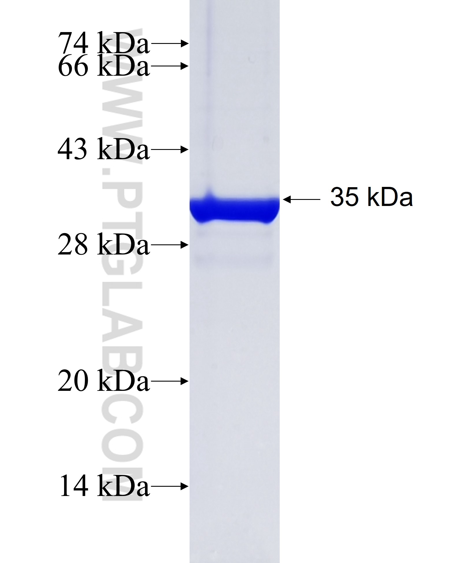 PTPN6 fusion protein Ag34996 SDS-PAGE PTPN6 fusion protein Ag34996 SDS-PAGE