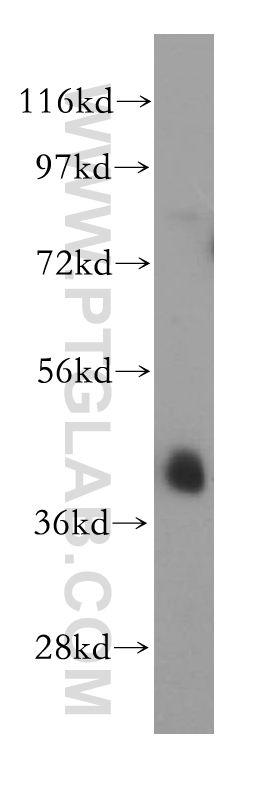 PTPN7 Polyclonal antibody