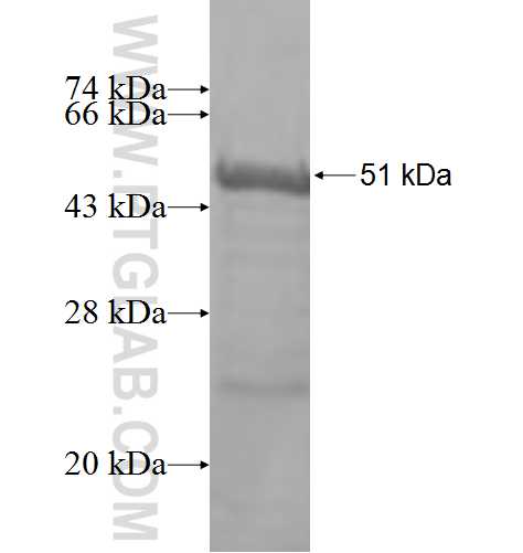 PTPN7 fusion protein Ag7469 SDS-PAGE PTPN7 fusion protein Ag7469 SDS-PAGE