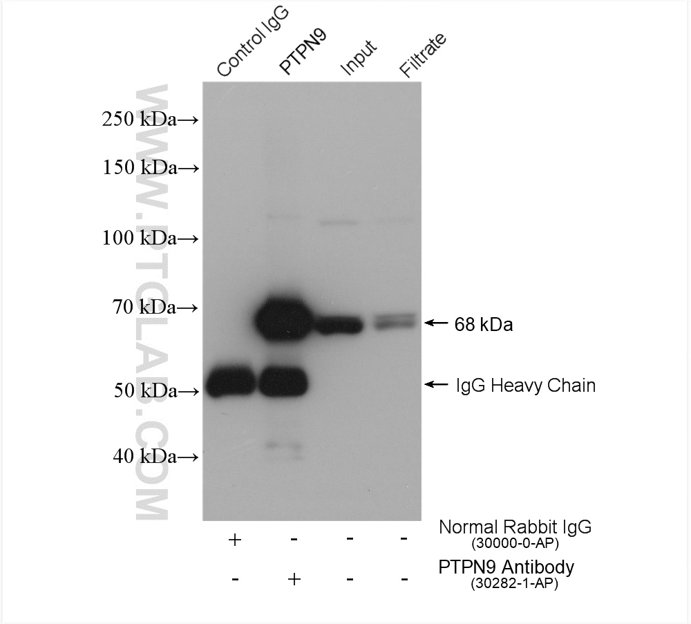 IP experiment of HEK-293 using 30282-1-AP