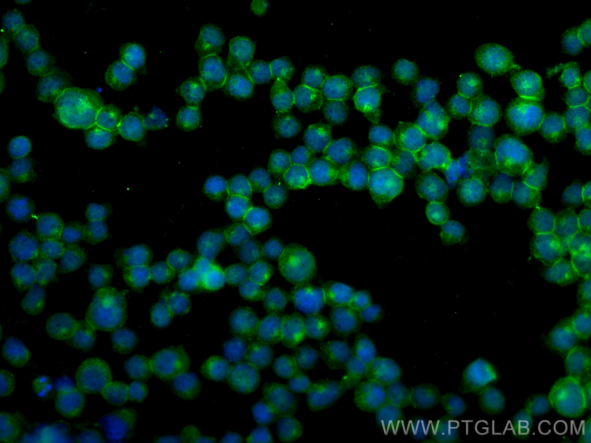 IF Staining of Jurkat using 19715-1-AP