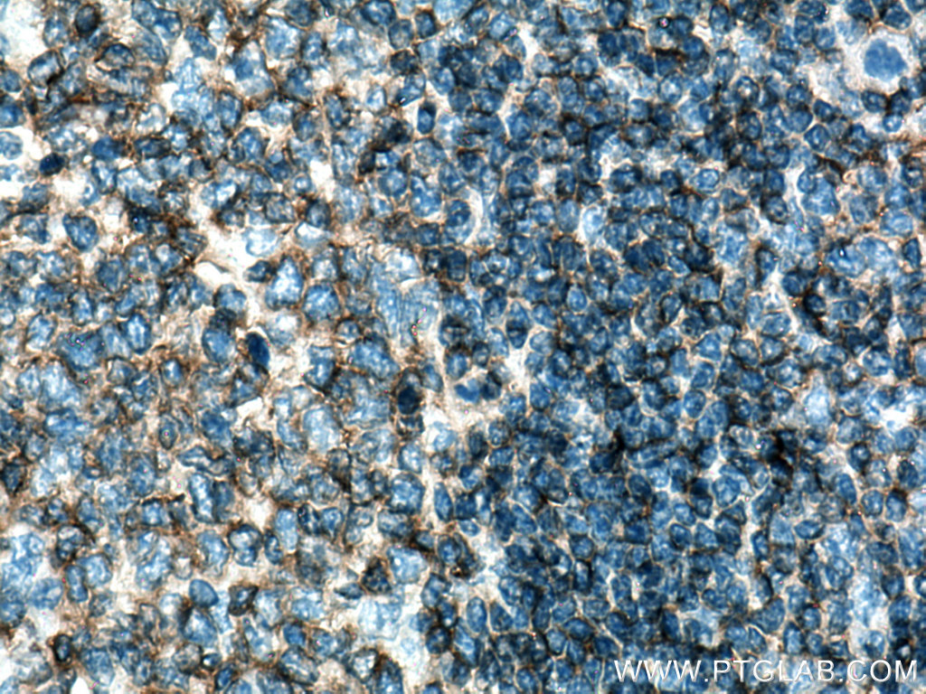 IHC staining of human tonsillitis using 19715-1-AP