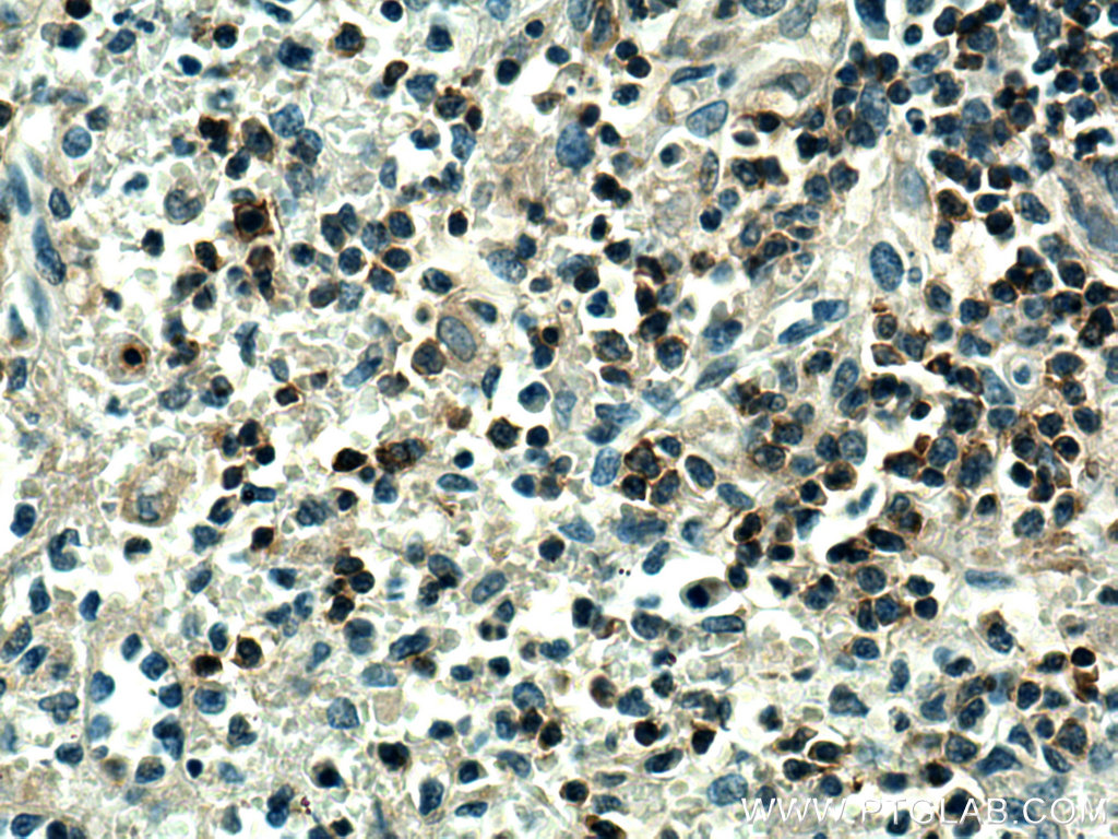 IHC staining of human spleen using 28286-1-AP