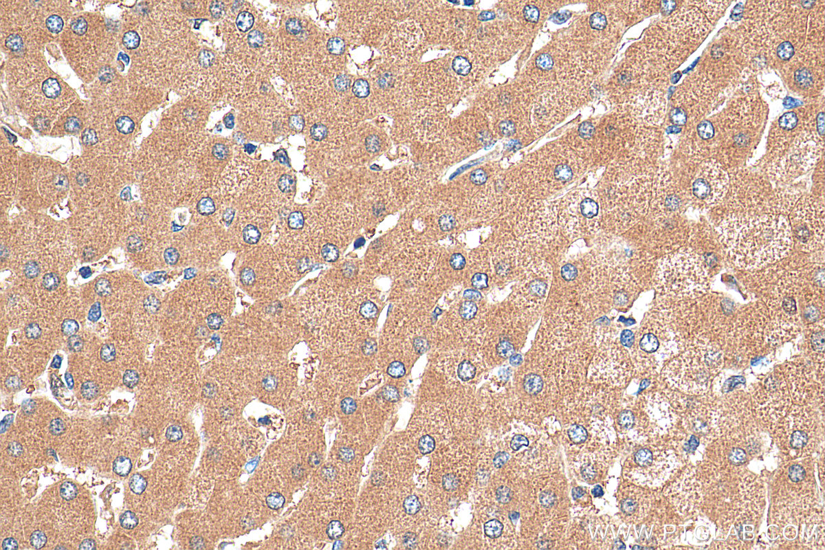 IHC staining of human liver using 27941-1-AP