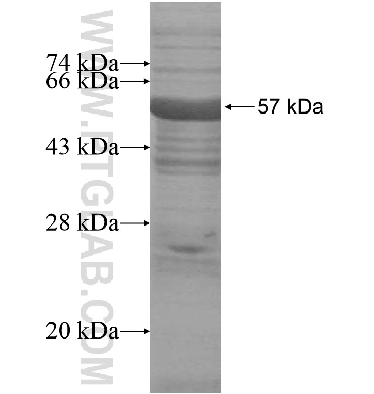 PTPRD fusion protein Ag16418 SDS-PAGE PTPRD fusion protein Ag16418 SDS-PAGE