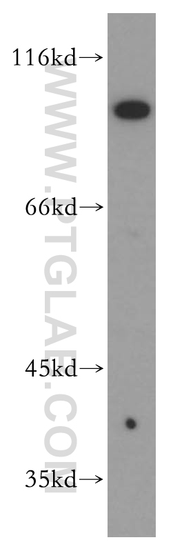 WB analysis of HL-60 using 13922-1-AP