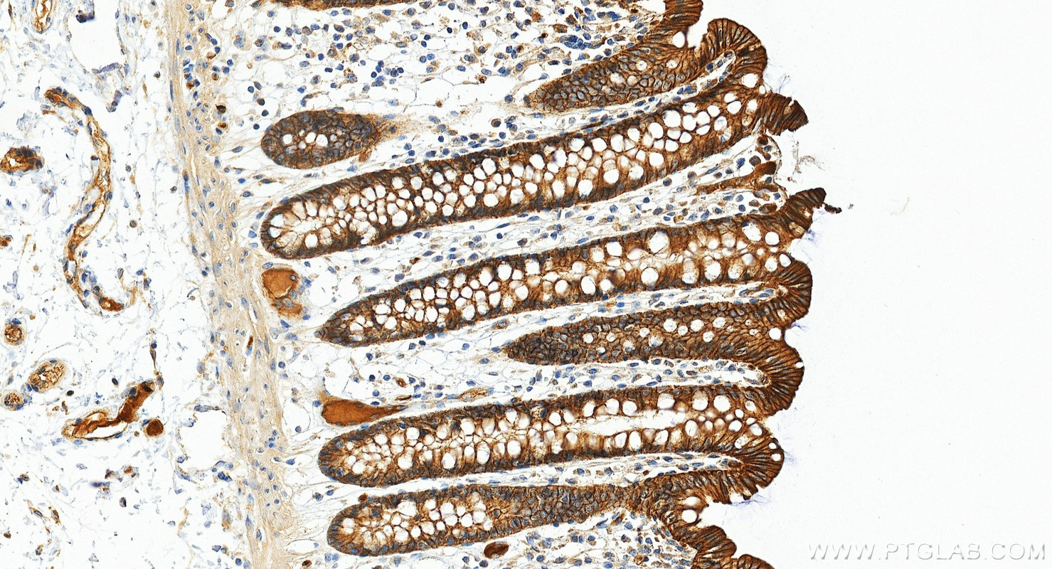 IHC staining of human colon using 33529-1-AP