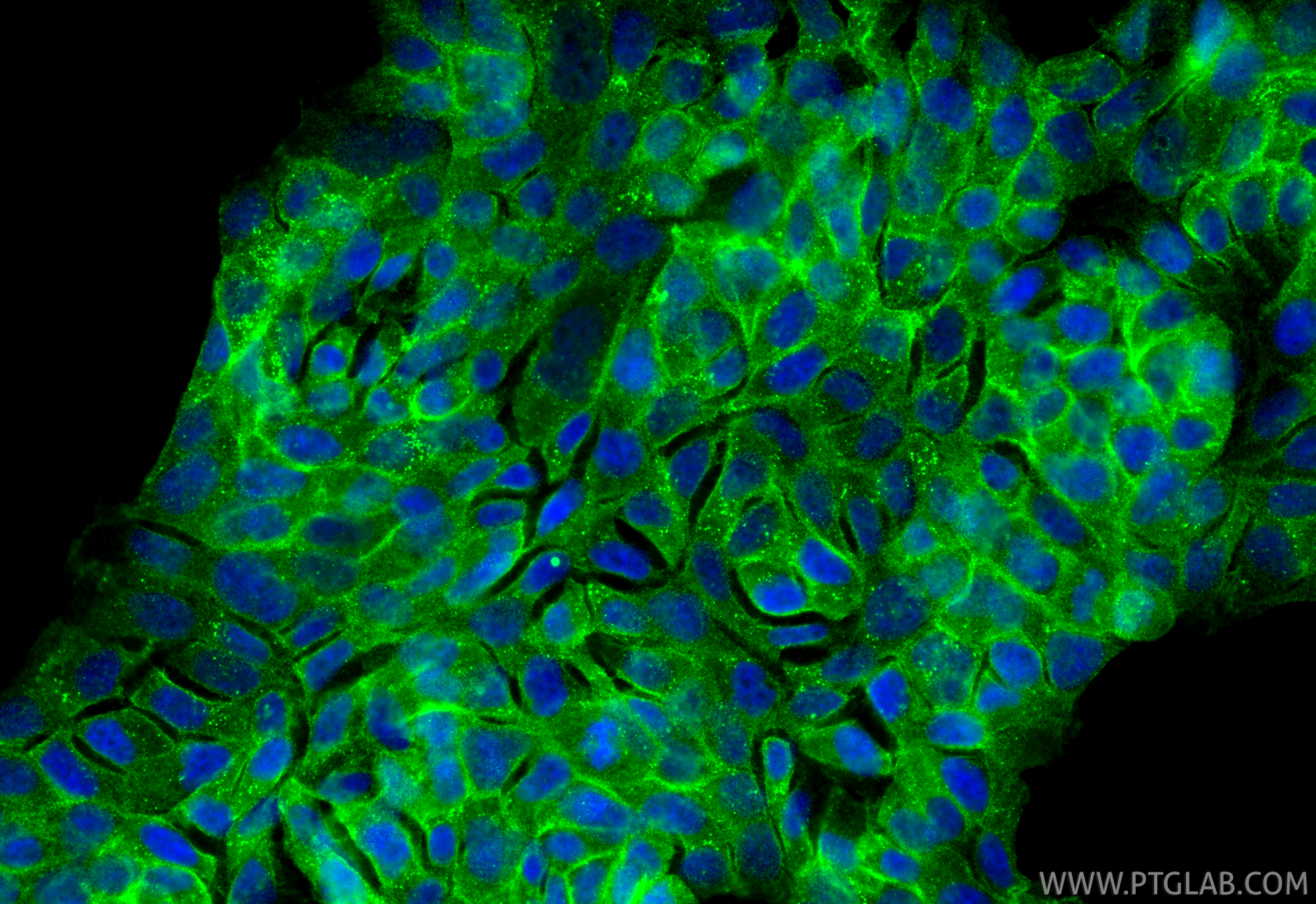 IF Staining of RT-4 using 33529-1-AP