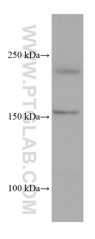 WB analysis of HSC-T6 using 68070-1-Ig