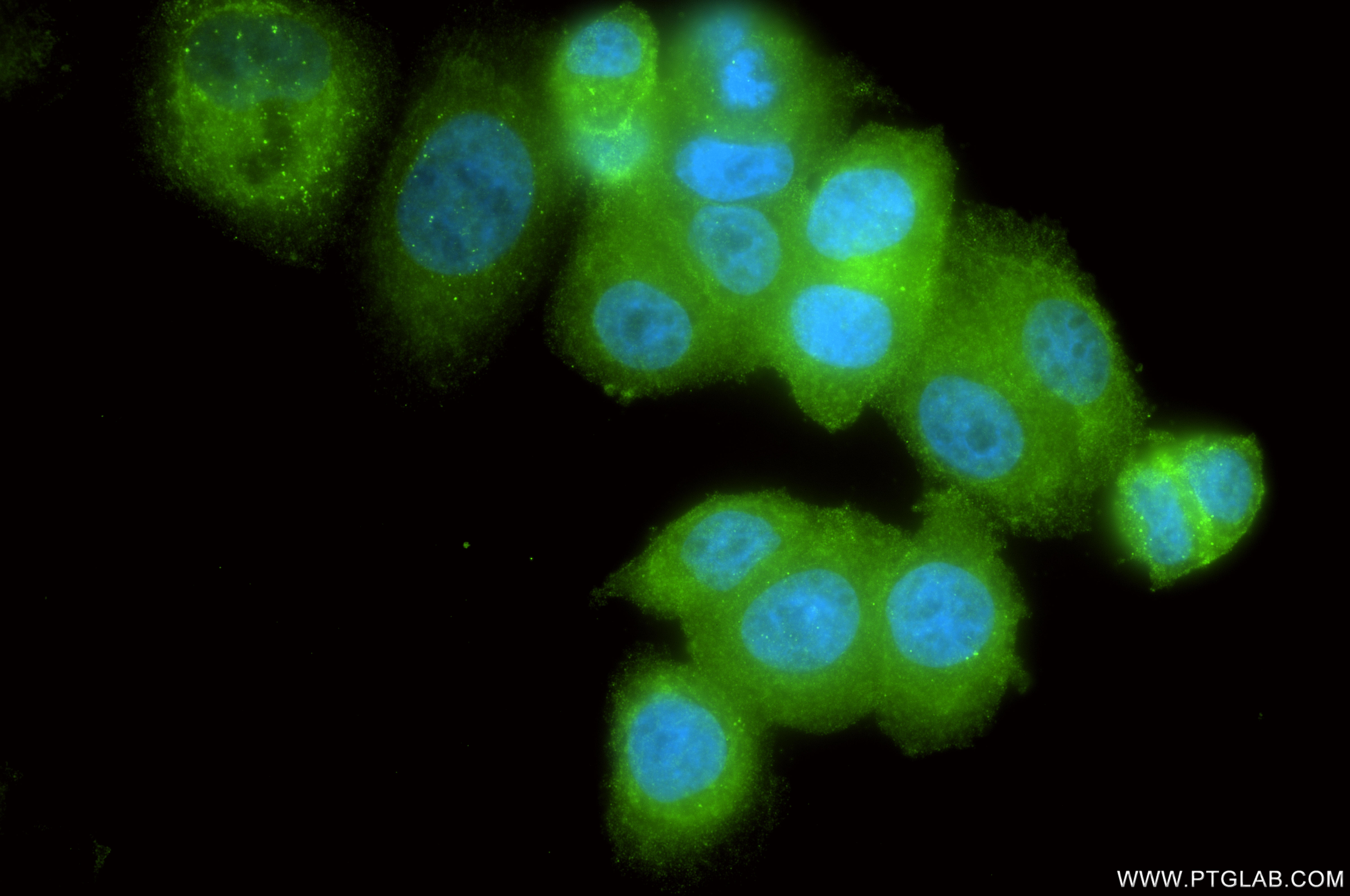 IF Staining of SK-BR-3 using 86944-1-RR (same clone as 86944-1-PBS) IF Staining of SK-BR-3 using 86944-1-RR (same clone as 86944-1-PBS)