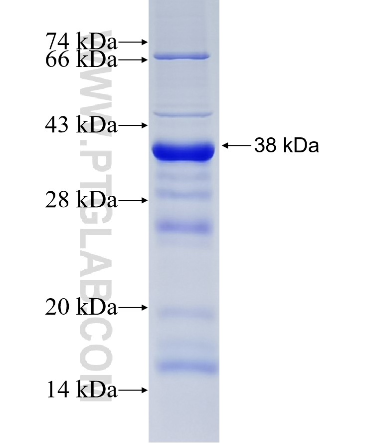 PTPRG fusion protein Ag19410 SDS-PAGE PTPRG fusion protein Ag19410 SDS-PAGE