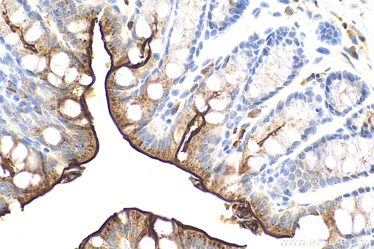 Immunohistochemical analysis of paraffin-embedded mouse colon tissue slide using 33732-1-AP (PTPRH antibody) at dilution of 1:200 (under 40x lens). Heat mediated antigen retrieval with Tris-EDTA buffer (pH 9.0). IHC staining of mouse colon using 33732-1-AP