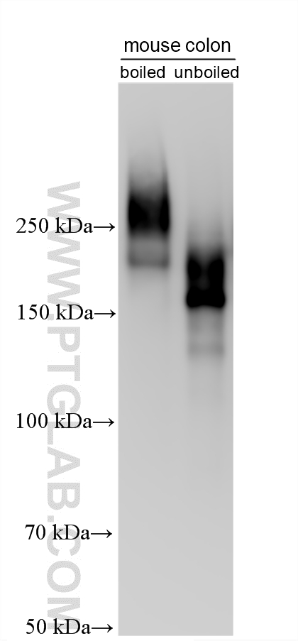 Various lysates were subjected to SDS PAGE followed by western blot with 33732-1-AP (PTPRH antibody) at dilution of 1:10000 incubated at room temperature for 1.5 hours. WB analysis using 33732-1-AP