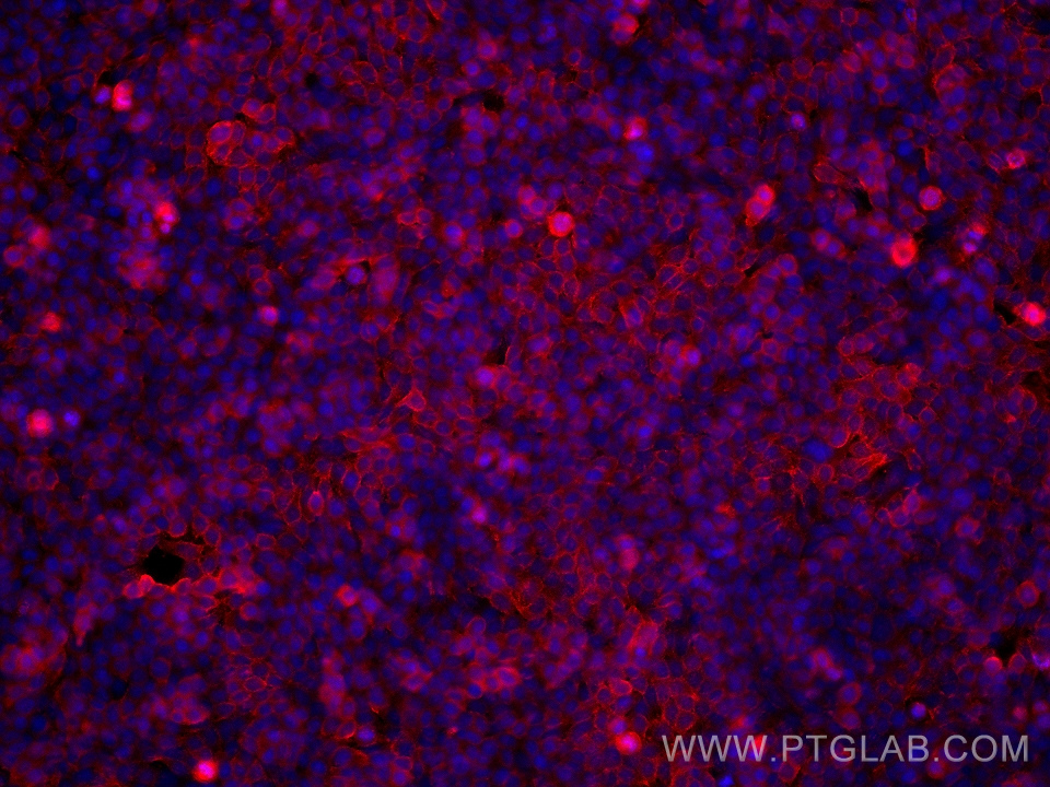 Immunofluorescent analysis of (4% PFA) fixed HT-29 cells using PTPRH antibody (<a class='green' href='/productredirect?CatalogNo=68635-1-Ig' target='_blank'>68635-1-Ig</a>, Clone: 3C6E8 ) at dilution of 1:500 and Multi-rAb CoraLite® Plus 594-Goat Anti-Mouse Recombinant Secondary Antibody (H+L) (Cat.NO. RGAM004 ). This data was developed using the same antibody clone with 68635-1-PBS in a different storage buffer formulation. IF Staining of HT-29 using 68635-1-Ig (same clone as 68635-1-PBS)
