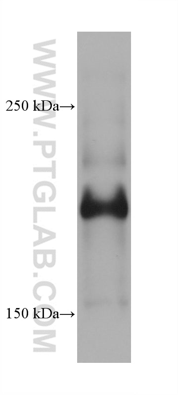 WB analysis of A431 using 68635-1-Ig