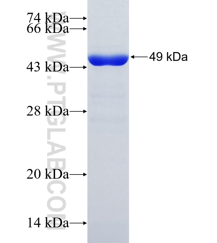 PTPRH fusion protein Ag35147 SDS-PAGE PTPRH fusion protein Ag35147 SDS-PAGE