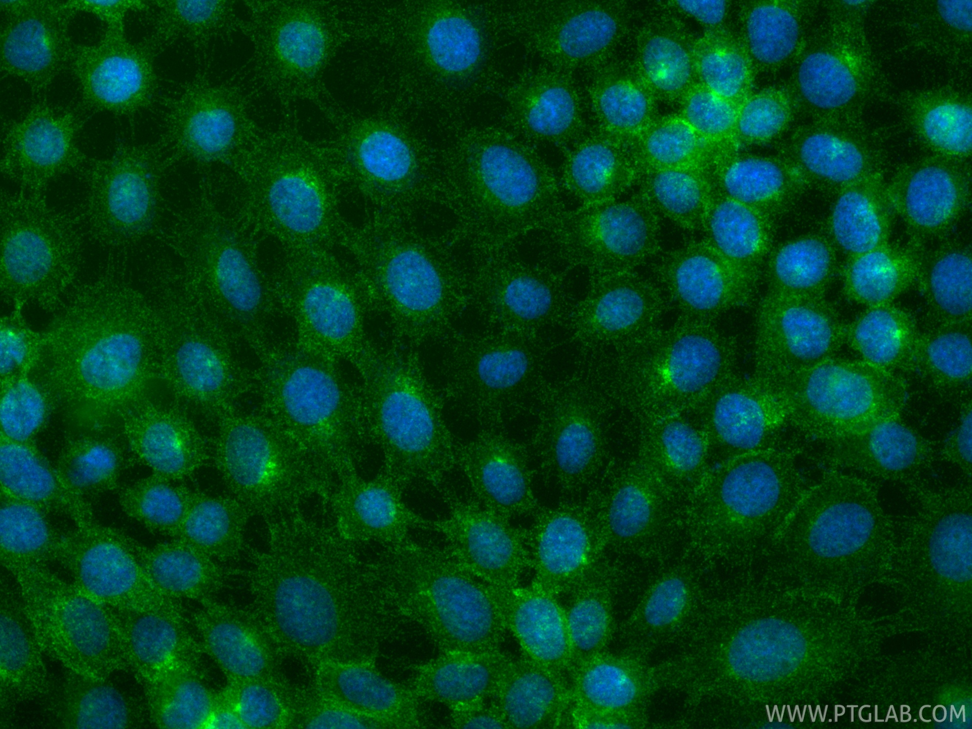 IF Staining of A431 using 98715-1-RR