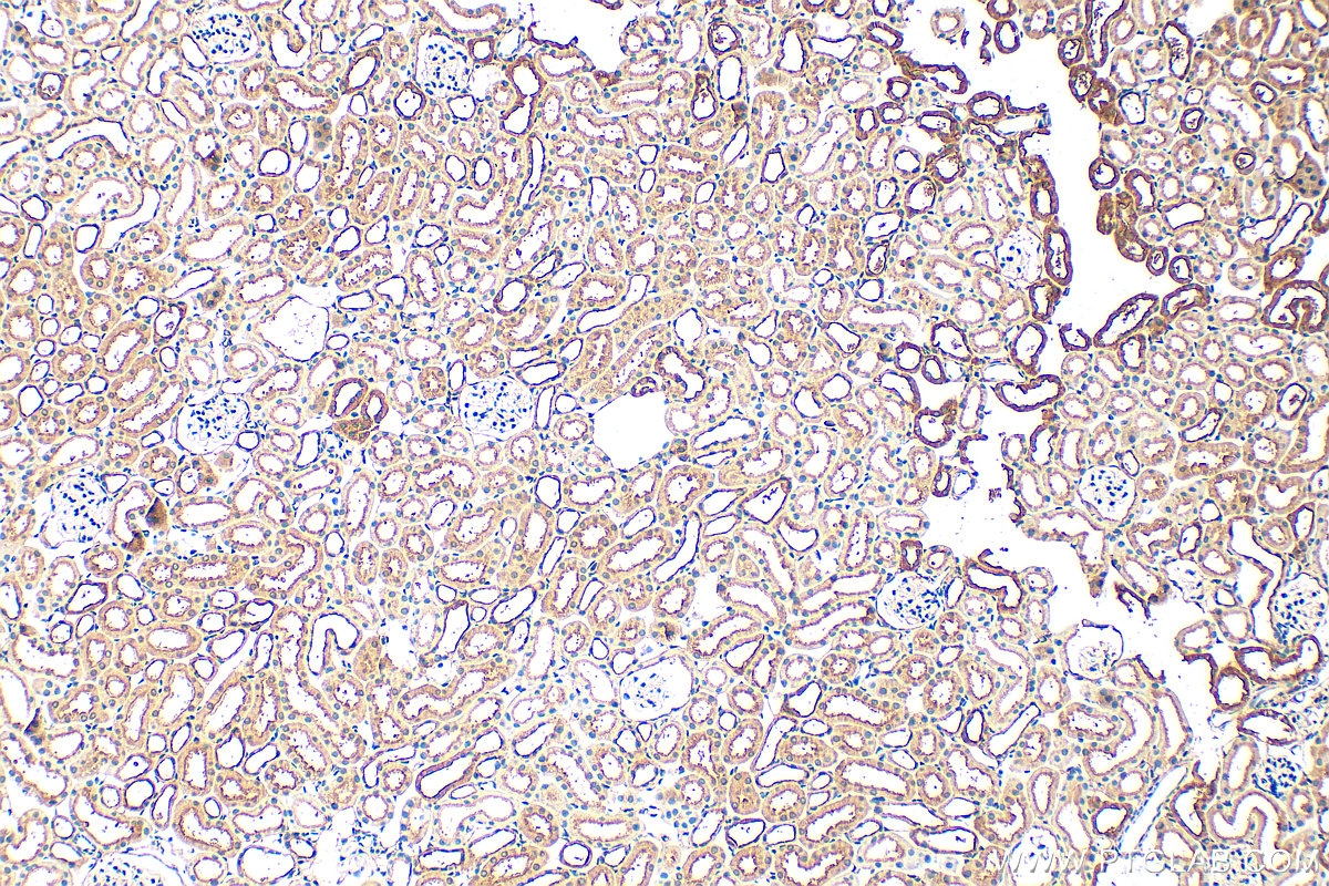 IHC staining of mouse kidney using 30763-1-AP