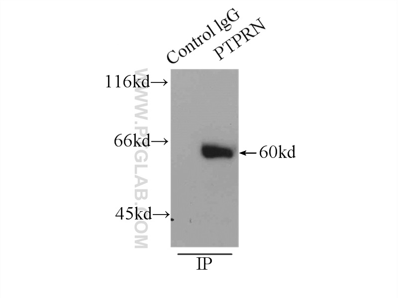 IP experiment of mouse brain using 10584-1-AP