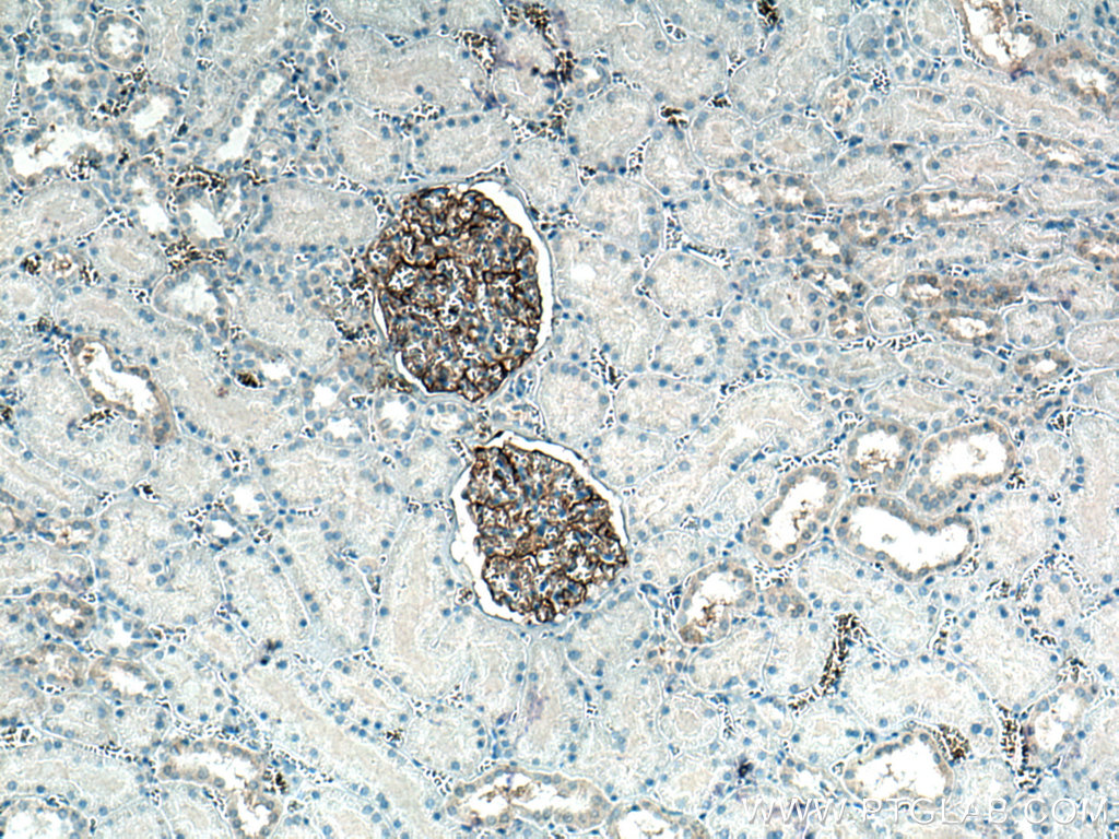 IHC staining of human kidney using 67000-1-Ig