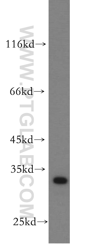 PTPRR Polyclonal antibody