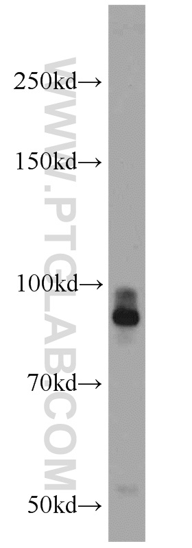 WB analysis of HeLa using 13008-1-AP